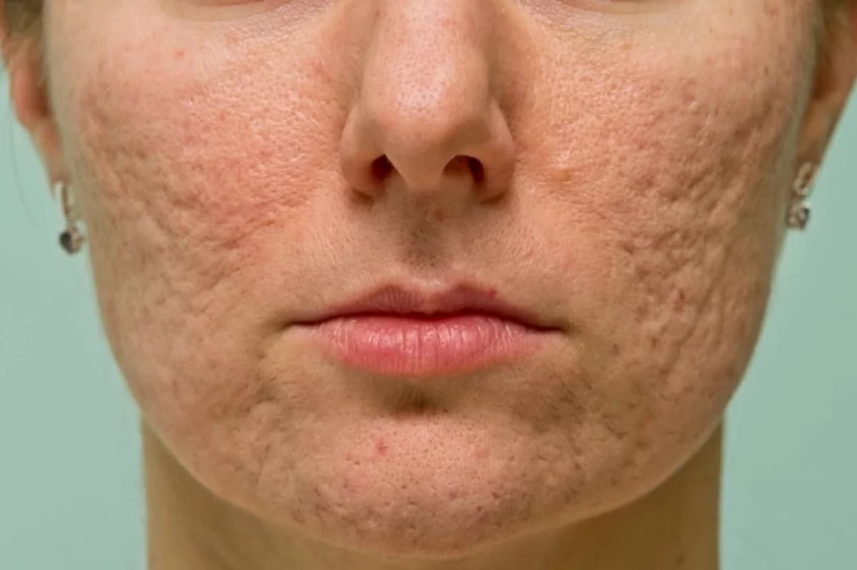 Опасная красота . Как косметологи могут изуродовать и лишить здоровья