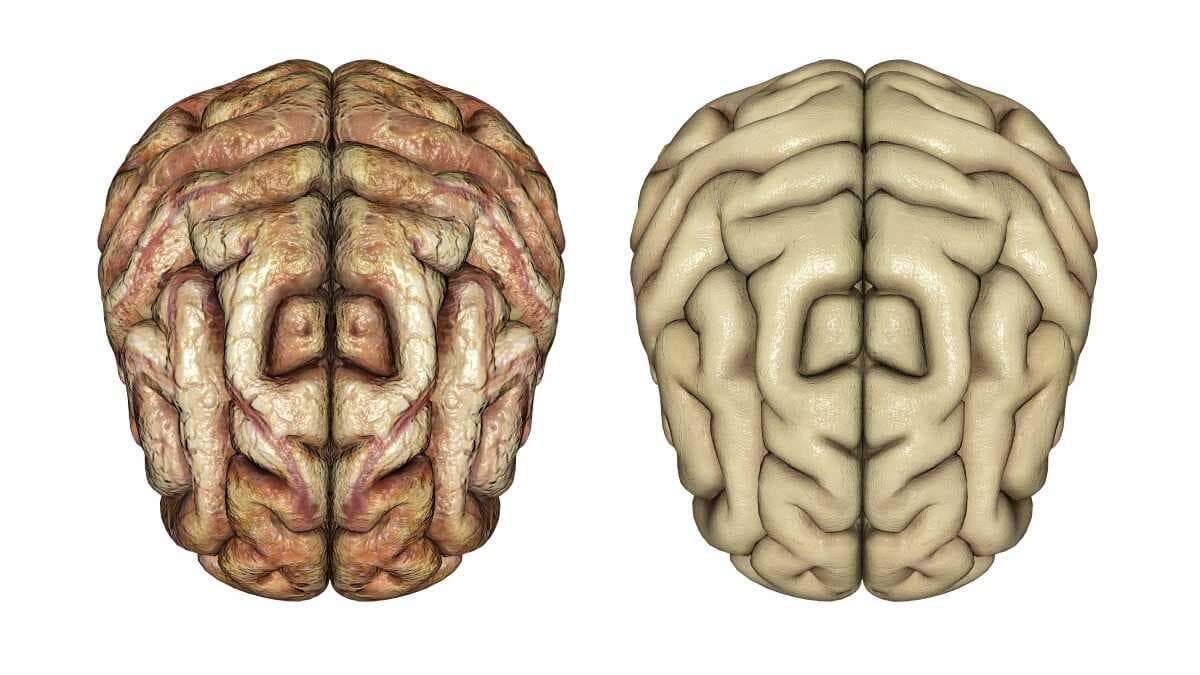 O que acelera o envelhecimento cerebral ? Cientistas apontam nova proteína como responsável