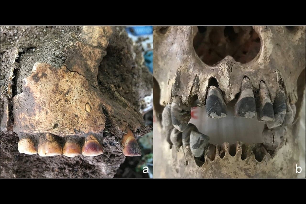 2,000-Year-Old Skulls Reveal How Vietnam’s Early Influencers Dyed Their Teeth Pitch Black—For Life