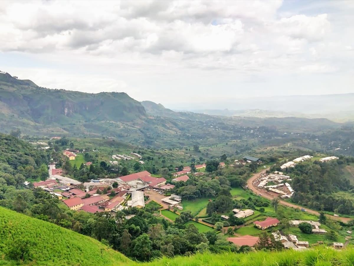 How UAB radiologist partnerships in Africa are bridging health care gaps through critical imaging support