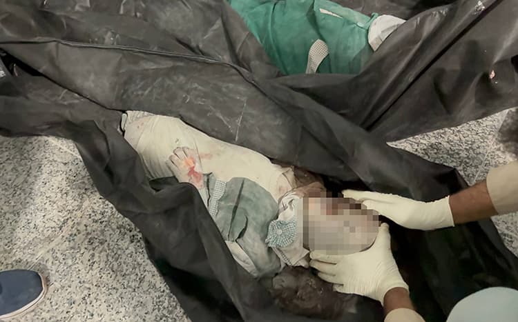 İran Kızılayı : ABD - İsrail saldırılarında şu ana kadar 201 kişi öldü , 747 kişi yaralandı