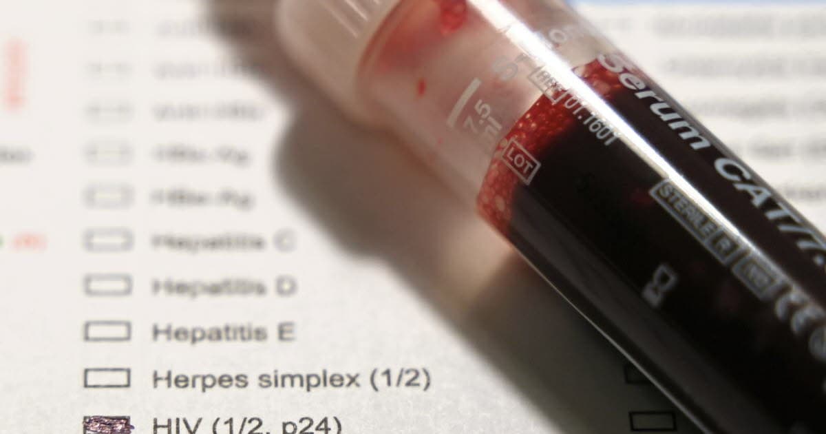 Santé . VIH : attendu de longue date , un traitement préventif par piqûres tous les deux mois arrive en France