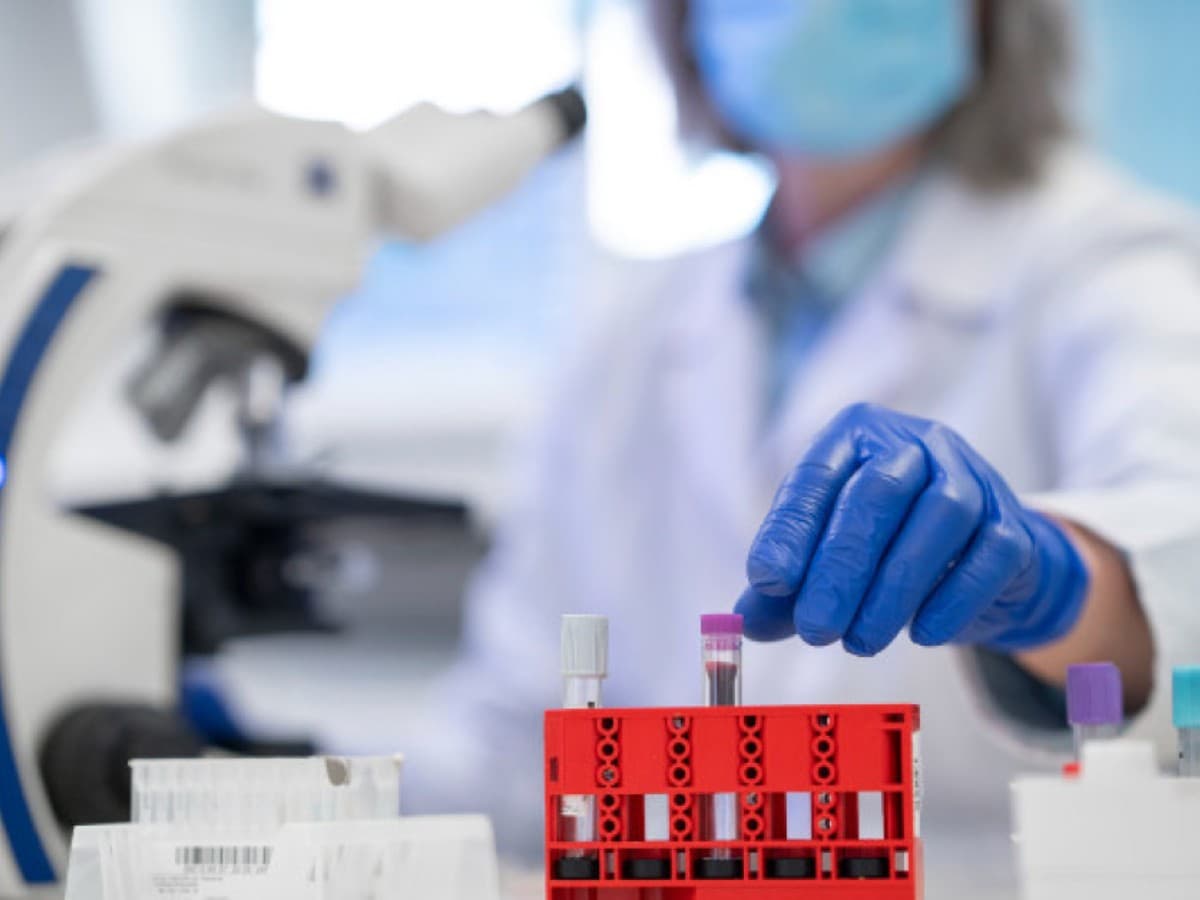 Liga de Hemofílicos habló de 20 años sin muertes por medicamentos , no en general