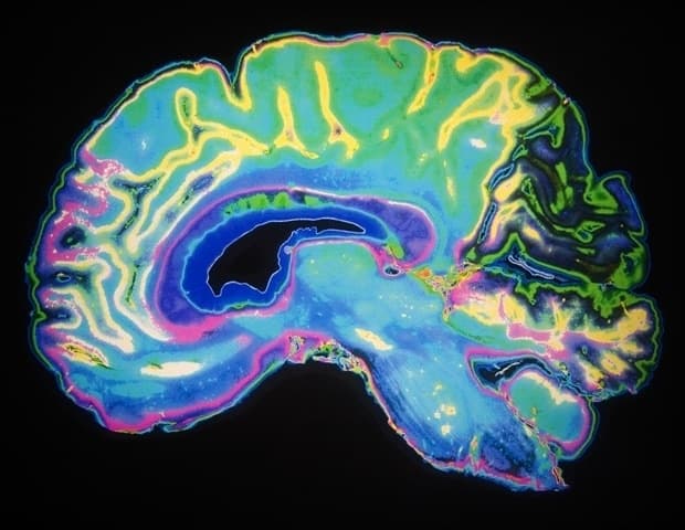 Scientists announce launch of the Society for Brain Health